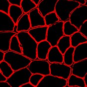 Fluorescent microscope image of a cross section of mouse tibialis anterior muscle labeled with DSHB antibody MANDRA(7A10). PMID: 33200567, Fig. 2F.